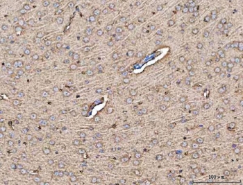 IHC staining of FFPE mouse brain tissue with MFAP3 antibody. HIER: boil tissue sections in pH8 EDTA for 20 min and allow to cool before testing.
