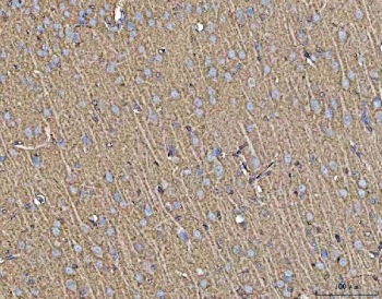 IHC staining of FFPE rat brain tissue with MFAP3 antibody. HIER: boil tissue sections in pH8 EDTA for 20 min and allow to cool before testing.