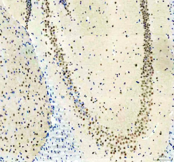 IHC staining of FFPE mouse brain tissue with PUS7L antibody, HRP-secondary and DAB substrate. HIER: boil tissue sections in pH8 EDTA for 20 min and allow to cool before testing.