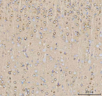 IHC staining of FFPE rat brain tissue with NPTXR antibody. HIER: boil tissue sections in pH8 EDTA for 20 min and allow to cool before testing.