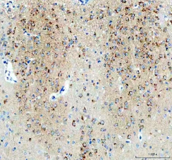 IHC staining of FFPE mouse brain tissue with NPTXR antibody. HIER: boil tissue sections in pH8 EDTA for 20 min and allow to cool before testing.