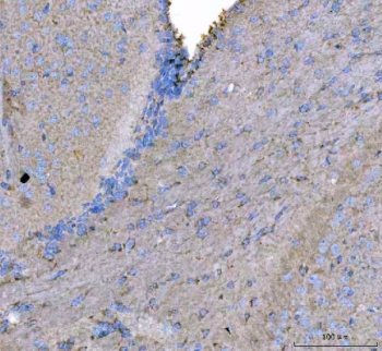 IHC staining of FFPE mouse brain tissue with MAP6D1 antibody. HIER: boil tissue sections in pH8 EDTA for 20 min and allow to cool before testing.