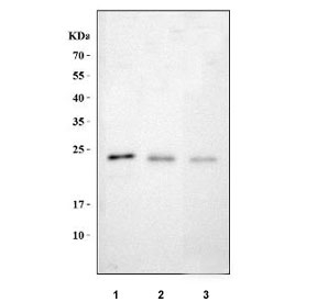 Western blot testing of 1) human T-47D, 2) rat brain and 3) mouse brain tissue with MAP6D1 antibody. Predicted molecular weight ~21 kDa.