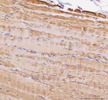 IHC staining of FFPE human skeletal muscle tissue with MYL5 antibody. HIER: boil tissue sections in pH8 EDTA for 20 min and allow to cool before testing.