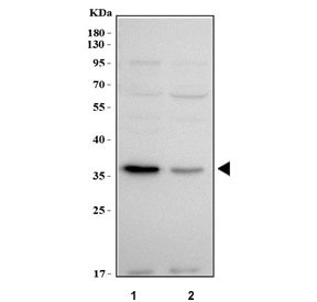 Western blot testing of human 1) A549 and 2) RT4 cell lysate with PROSER3 antibody. Predicted molecular weight ~51/35/21 kDa (multiple isoforms).