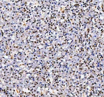IHC staining of FFPE human spleen tissue with Aryl Hydrocarbon Receptor Repressor antibody. HIER: boil tissue sections in pH8 EDTA for 20 min and allow to cool before testing.