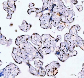 IHC staining of FFPE human placental tissue with Aryl Hydrocarbon Receptor Repressor antibody. HIER: boil tissue sections in pH8 EDTA for 20 min and allow to cool before testing.
