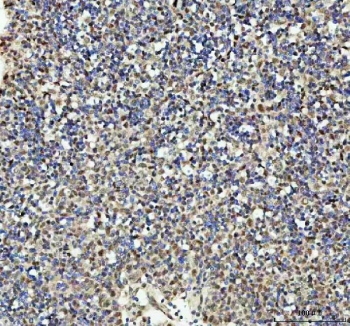IHC staining of FFPE human spleen tissue with PSIP1 antibody. HIER: boil tissue sections in pH8 EDTA for 20 min and allow to cool before testing.