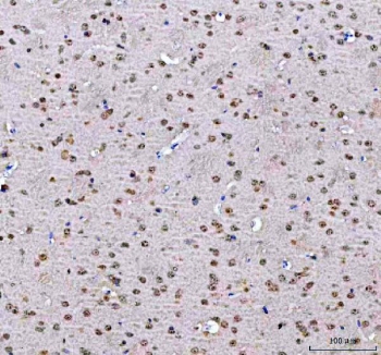 IHC staining of FFPE mouse brain tissue with PSIP1 antibody. HIER: boil tissue sections in pH8 EDTA for 20 min and allow to cool before testing.