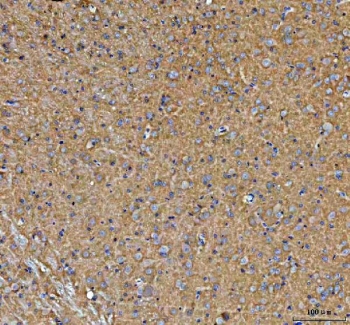 IHC staining of FFPE rat brain tissue with Paralemmin antibody. HIER: boil tissue sections in pH8 EDTA for 20 min and allow to cool before testing.