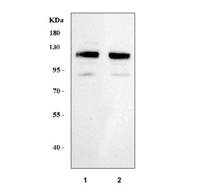 Western blot testing of human 1) K562 and 2) HEL cell lysate with LRIG2 antibody. Predicted molecular weight ~119 kDa.