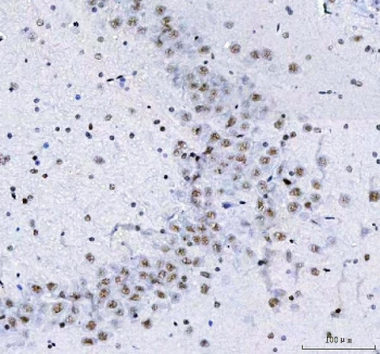 IHC staining of FFPE rat brain tissue with LUC7L3 antibody. HIER: boil tissue sections in pH8 EDTA for 20 min and allow to cool before testing.