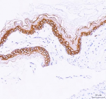 IHC staining of FFPE rat stomach tissue with LYPD3 antibody. HIER: boil tissue sections in pH8 EDTA for 20 min and allow to cool before testing.