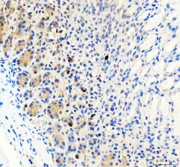 IHC staining of FFPE mouse stomach tissue with LYPLA2 antibody. HIER: boil tissue sections in pH8 EDTA for 20 min and allow to cool before testing.