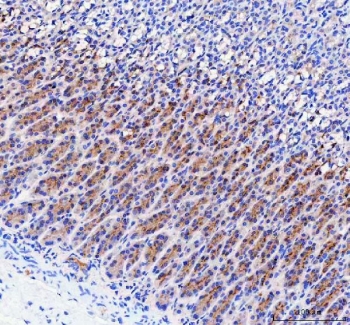 IHC staining of FFPE rat stomach tissue with LYPLA2 antibody. HIER: boil tissue sections in pH8 EDTA for 20 min and allow to cool before testing.