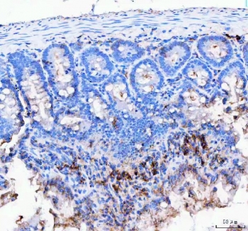 J Chain Antibody Rat Colon IHC. Immunohistochemistry of FFPE rat colon tissue using J Chain antibody demonstrates focal HRP-DAB brown cytoplasmic staining in scattered lamina propria immune cells and mucosal-associated plasma cell populations, consistent with JCHAIN / IGJ expression involved in secretory immunoglobulin production and mucosal immune defense. HIER: boil tissue sections in pH8 EDTA for 20 min and allow to cool before testing.