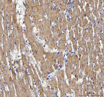 IHC staining of FFPE rat heart tissue with ATP5F1D antibody. HIER: boil tissue sections in pH8 EDTA for 20 min and allow to cool before testing.
