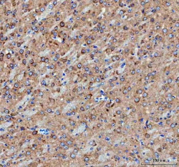 IHC staining of FFPE mouse brain tissue with IDUA antibody. HIER: boil tissue sections in pH8 EDTA for 20 min and allow to cool before testing.
