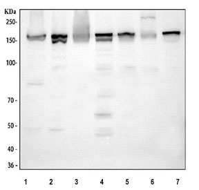 Western blot testing of 1) human Jurkat, 2) human RT4, 3) human K562, 4) rat heart, 5) rat liver, 6) mouse heart and 7) mouse liver tissue lysate with 4-Alpha-glucanotransferase antibody. Predicted molecular weight ~174 kDa.