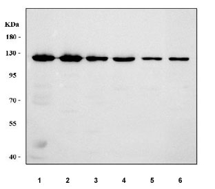 Western blot testing of 1) human MCF7, 2) human SH-SY5Y, 3) human RT4, 4) human HepG2, 5) rat brain and 6) mouse brain tissue lysate with Matrin 3 antibody. Predicted molecular weight ~95 kDa, commonly observed at ~125 kDa.