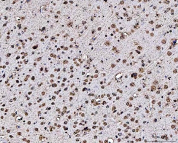 IHC staining of FFPE mouse brain tissue with Matrin 3 antibody. HIER: boil tissue sections in pH8 EDTA for 20 min and allow to cool before testing.