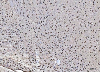 IHC staining of FFPE rat brain tissue with Matrin 3 antibody. HIER: boil tissue sections in pH8 EDTA for 20 min and allow to cool before testing.