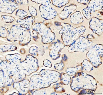 IHC staining of FFPE human placental tissue with IDH3G antibody. HIER: boil tissue sections in pH8 EDTA for 20 min and allow to cool before testing.