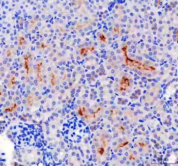 IHC staining of FFPE human mouse kidney tissue with Lumican antibody. HIER: boil tissue sections in pH8 EDTA for 20 min and allow to cool before testing.