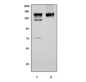 Western blot testing of 1) rat liver and 2) mouse liver tissue lysate with DAPK1 antibody. Predicted molecular weight ~160 kDa with multiple isoforms.