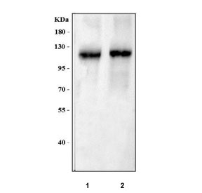Western blot testing of 1) rat testis and 2) mouse testis tissue lysate with AF10 antibody. Predicted molecular weight ~113 kDa.