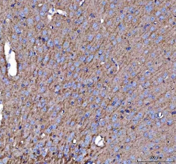 IHC staining of FFPE mouse brain tissue with Amyloid-like protein 2 antibody. HIER: boil tissue sections in pH8 EDTA for 20 min and allow to cool before testing.