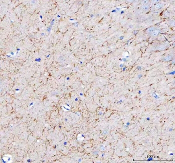 IHC staining of FFPE rat brain tissue with Amyloid-like protein 2 antibody. HIER: boil tissue sections in pH8 EDTA for 20 min and allow to cool before testing.