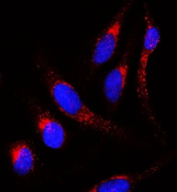 Immunofluorescent staining of FFPE human HeLa cells with Amyloid-like protein 2 antibody (red) and DAPI nuclear stain (blue). HIER: steam section in pH6 citrate buffer for 20 min.