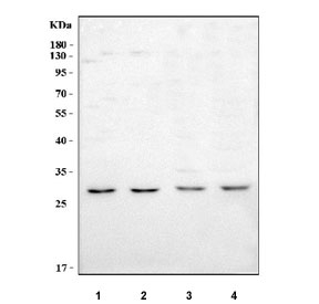 Western blot testing of 1) human Jurkat, 2) human HepG2, 3) rat brain and 4) mouse brain tissue lysate with IFFO1 antibody. Predicted molecular weight ~23 kDa, 28 kDa and 62 kDa (multiple isoforms).