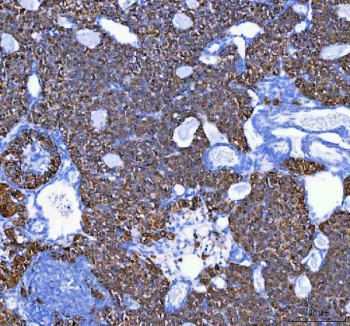 IHC staining of FFPE mouse ovary tissue with MELK antibody. HIER: boil tissue sections in pH8 EDTA for 20 min and allow to cool before testing.