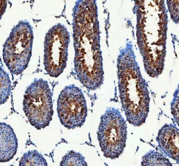 IHC staining of FFPE rat testis tissue with PDK3 antibody. HIER: boil tissue sections in pH8 EDTA for 20 min and allow to cool before testing.