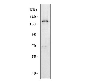 Western blot testing of human Jurkat cell lysate with PARP10 antibody. Predicted molecular weight ~110 kDa but can be observed at up to ~150 kDa.