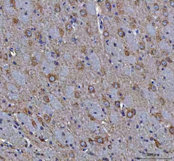 IHC staining of FFPE rat brain tissue with MAP1S antibody. HIER: boil tissue sections in pH8 EDTA for 20 min and allow to cool before testing.