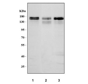 Western blot testing of human 1) HeLa, 2) RT4 and 3) HepG2 cell lysate with MAP1S antibody. Predicted molecular weight ~112 KDa, commonly observed at 112-150 kDa.