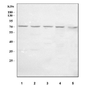 Western blot testing of 1) human A549, 2) human A431, 3) human MCF7, 4) rat C6 and 5) mouse Neuro-2a cell lysate with LCTL antibody. Predicted molecular weight ~65 kDa but may be observed at higher molecular weights due to glycosylation.