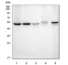 Western blot testing of 1) human 293T, 2) human HeLa, 3) human Jurkat, 4) rat thymus and 5) mouse thymus tissue lysate with LPCAT2 antibody. Predicted molecular weight ~60 kDa.