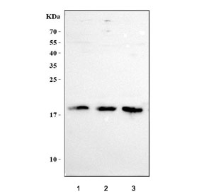 Western blot testing of human 1) RT4, 2) MCF7 and 3) SiHa cell lysate with LYPD6 antibody. Predicted molecular weight ~19 kDa.