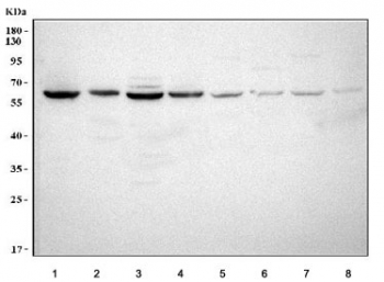 Western blot testing of 1) human HepG2, 2) human HaCaT, 3) human SiHa, 4) human U-251, 5) rat brain, 6) rat stomach, 7) mouse brain and 8) mouse stomach tissue lysate with LGI4 antibody. Predicted molecular weight ~59 kDa.