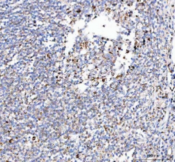 IHC staining of FFPE human tonsil tissue with Pellino-3 antibody. HIER: boil tissue sections in pH8 EDTA for 20 min and allow to cool before testing.