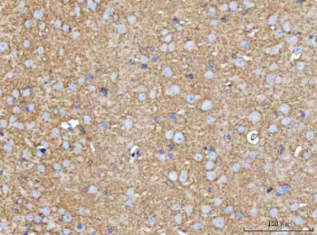 IHC staining of FFPE mouse brain tissue with MOSPD2 antibody. HIER: boil tissue sections in pH8 EDTA for 20 min and allow to cool before testing.