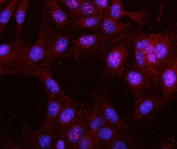 LRRN4 Antibody IF. Immunofluorescent staining of FFPE human U-2 OS cells with LRRN4 Antibody / Cancer-Associated LRR Protein Antibody (red) demonstrates predominantly cytoplasmic fluorescence with punctate perinuclear and occasional nuclear-associated signal, supporting an intracellular localization pattern for Leucine rich repeat neuronal protein 4 / LRRN4 in tumor-derived cells. DAPI nuclear counterstain appears blue. HIER: steam section in pH6 citrate buffer for 20 min.