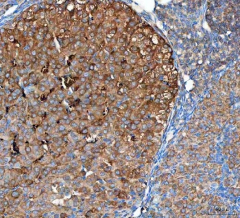 IHC staining of FFPE mouse ovary tissue with OTUB1 antibody. HIER: boil tissue sections in pH8 EDTA for 20 min and allow to cool before testing.