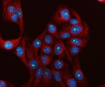 Immunofluorescent staining of FFPE human HeLa cells with IMP4 antibody (green), Beta Tubulin mAb (red) and DAPI nuclear stain (blue). HIER: steam section in pH6 citrate buffer for 20 min.