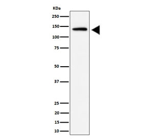 Western blot testing of human HeLa cell lysate with IPO9 antibody. Predicted molecular weight ~116 kDa, but it is often observed at higher molecular weights due to protein complexing.