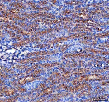 IHC staining of FFPE rat kidney tissue with RAB3IP antibody. HIER: boil tissue sections in pH8 EDTA for 20 min and allow to cool before testing.